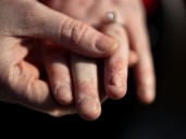 Ask the Expert: Orthopedic surgeon specializes in hand surgery, carpal tunnel
