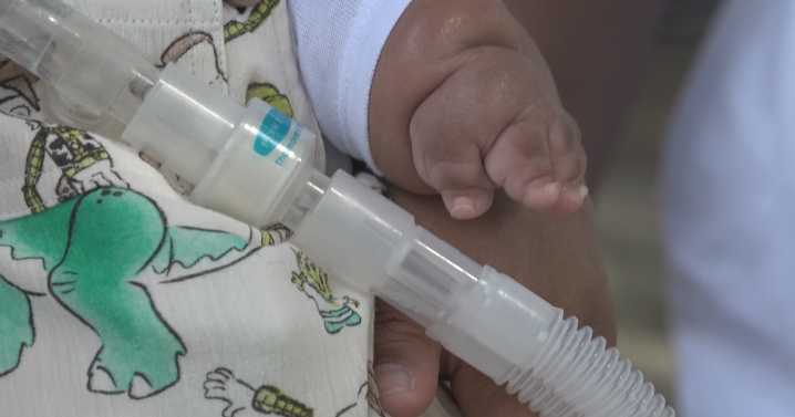 Charlottesville toddler with rare disorder celebrates second birthday at home