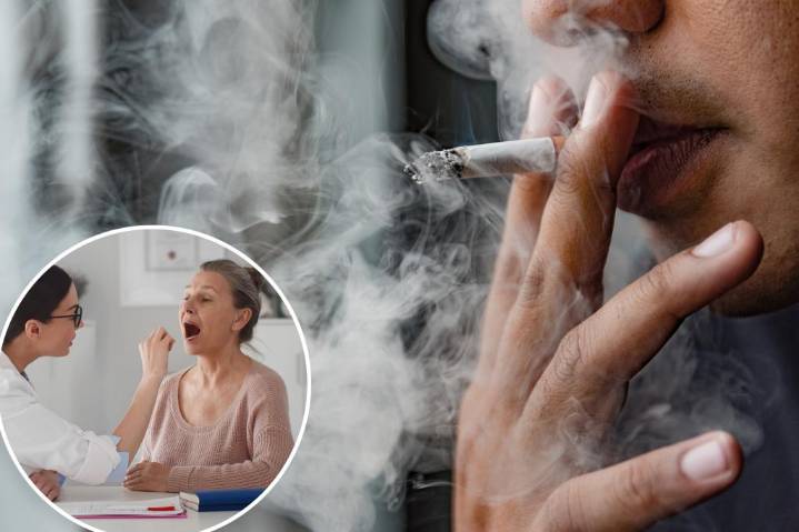 Pairing cigarettes with another habit ups oral cancer risk by 624%