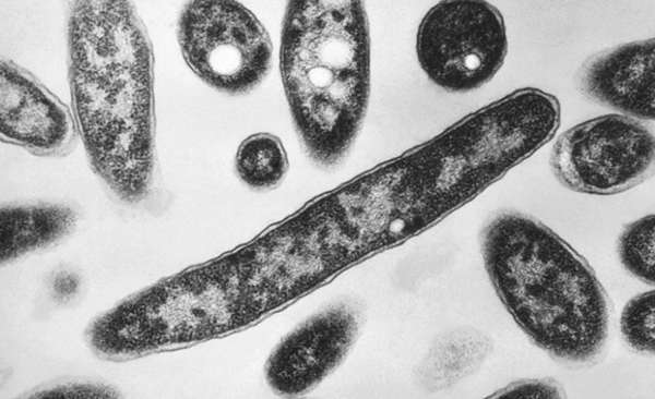 4th person dies in Legionnaires' disease outbreak in New York City