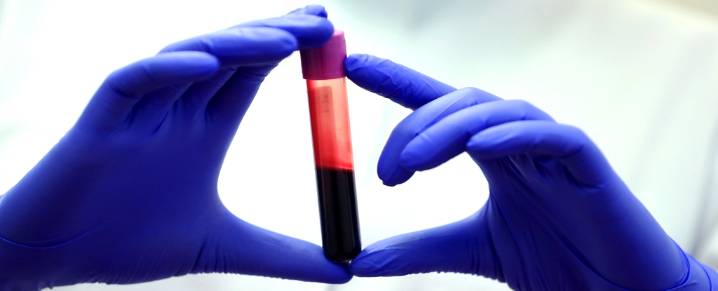 The Blood of Exceptionally Long-Lived People Suggests Key Differences
