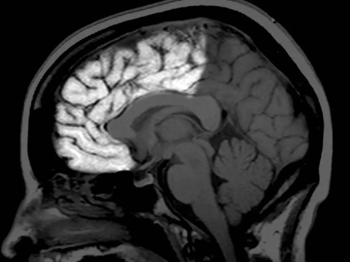Descubren que el cerebro humano puede activar un "sexto sentido"