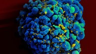 Whatever happened to ... the race to cure HIV? There's promising news : Goats and Soda : NPR
