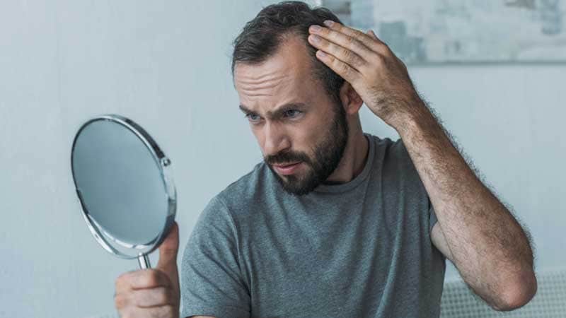 Minoxidil oral a dosis bajas no aumenta el riesgo de taquicardia