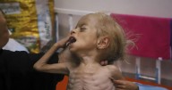 Malnourished kids arrive daily at a Gaza hospital as Israeli Prime Minister Benjamin Netanyahu denies hunger