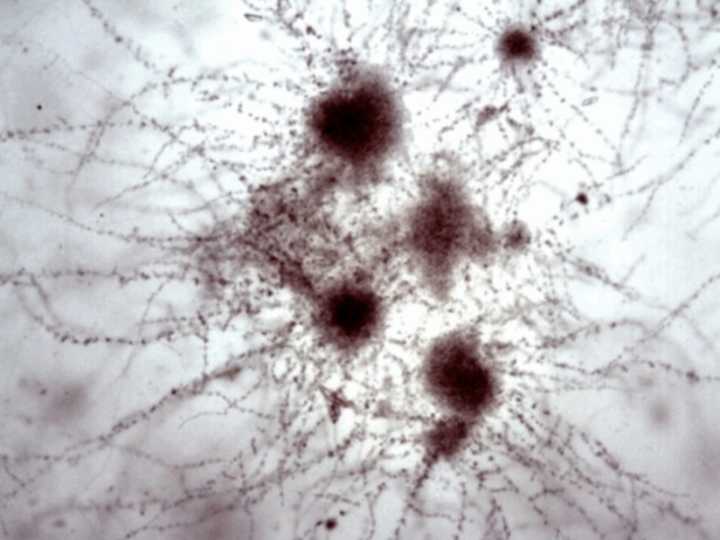Concurso de Fotografía Microbiológica 2025: conocé a los ganadores