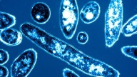 Infection disease doctor on preventing Legionnaires