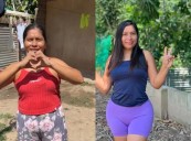 Lis Padilla, la influencer de “Amores que matan, pum pum pum”, pasó por el quirófano y quedó irreconocible