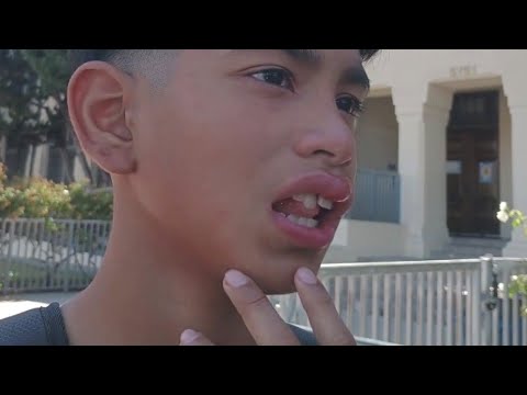 Child says school bully attacked him using brass knuckles