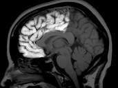 Descubren que el cerebro humano puede activar un "sexto sentido"