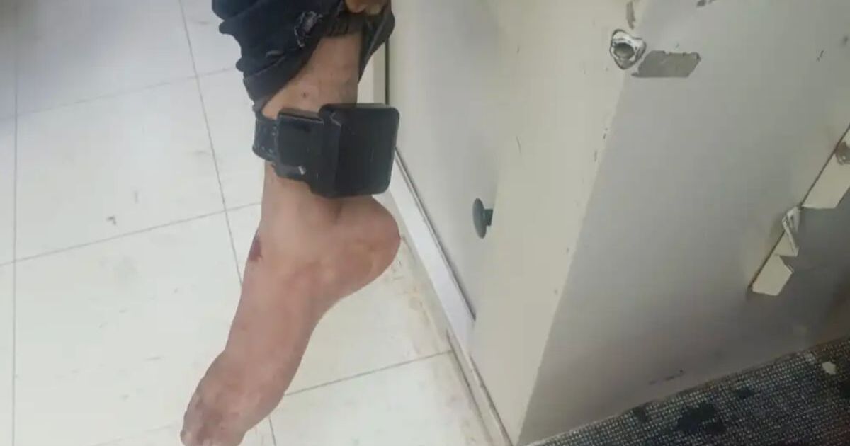 Detienen en Ecatepec a hombre con brazalete electrónico buscado por homicidio y extorsión