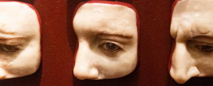 Secret Bodies No Longer to Be Displayed at US Medical Museum