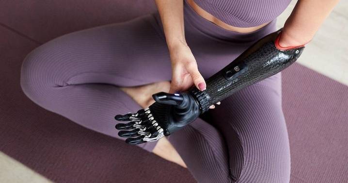 Brain Map Explains Phantom Limb Pain, Hints At Improved Prosthetics