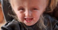 A 2nd Opinion Saved Baby Born with Infant-Type Hemispheric Glioma