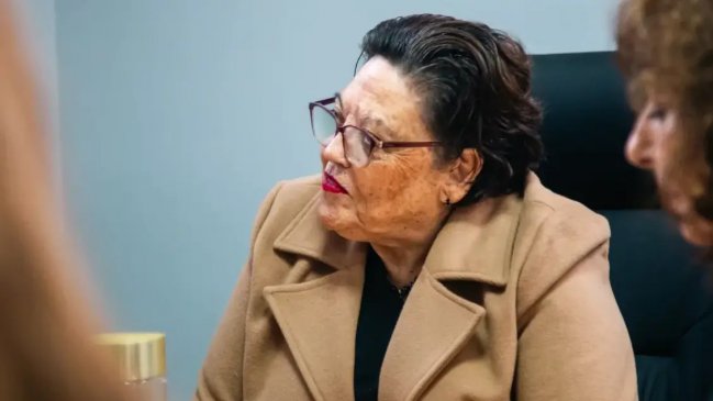 Defensa de funcionaria acusada de atropellar a niño y huir: "No mostró lesión importante"