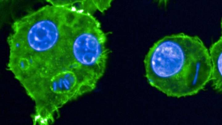 Plague Case Confirmed Near Lake Tahoe After Likely Flea Bite