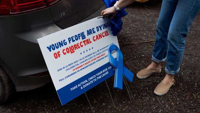 Colorectal Cancer in Young Adults: Screening and Prevention