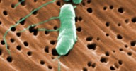 ¿Cómo es la bacteria 'carnívora' que ha dejado ya seis muertos en Estados Unidos?