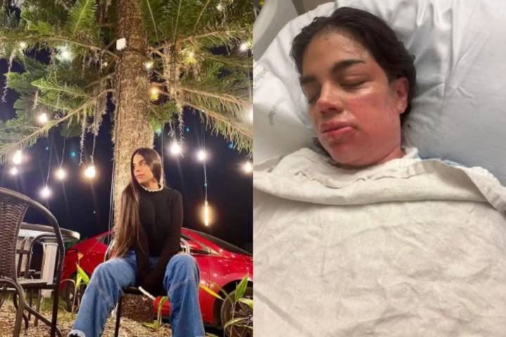Colombiana de 27 años sufrió quemaduras en el 80% de su cuerpo en bar de Nueva York