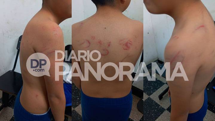 Detienen a una catequista por golpear salvajemente a su hijo de 8 años: fue denunciada por su propio hermano