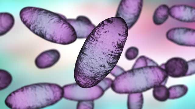 New Mexico reports first plague case of 2025