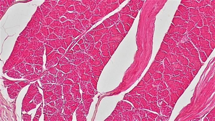 Sarepta’s Future in Gene Therapy Remains Clouded, But Data From Partner Hansa Is a Bright Spot