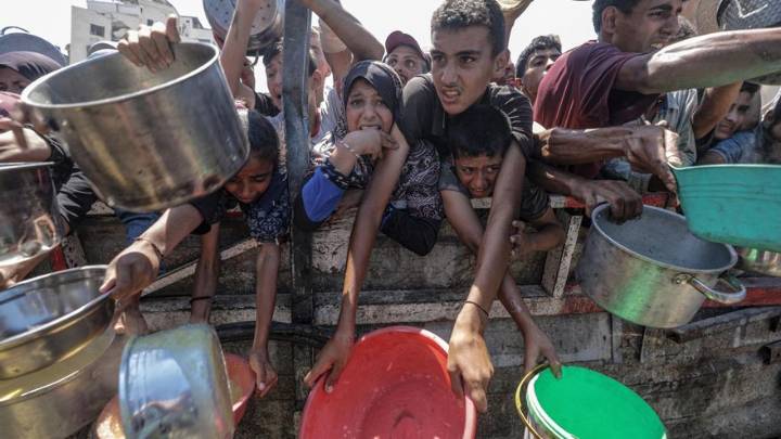 La cifra de niños muertos por desnutrición en Gaza aumenta a 100 desde el inicio de la ofensiva