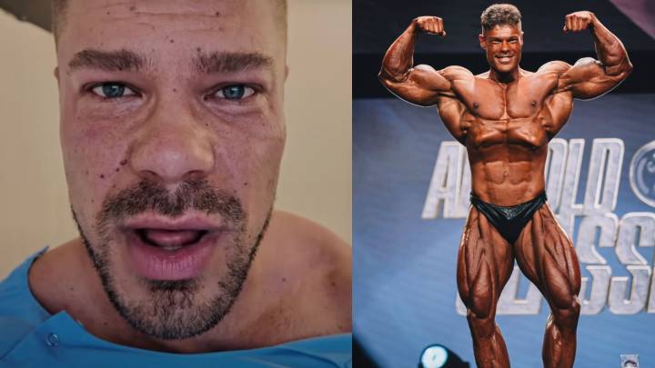 Bodybuilder Wesley Vissers Undergoes Hernia Surgery, Preparing to be 'Best Possible Version' in 2026 