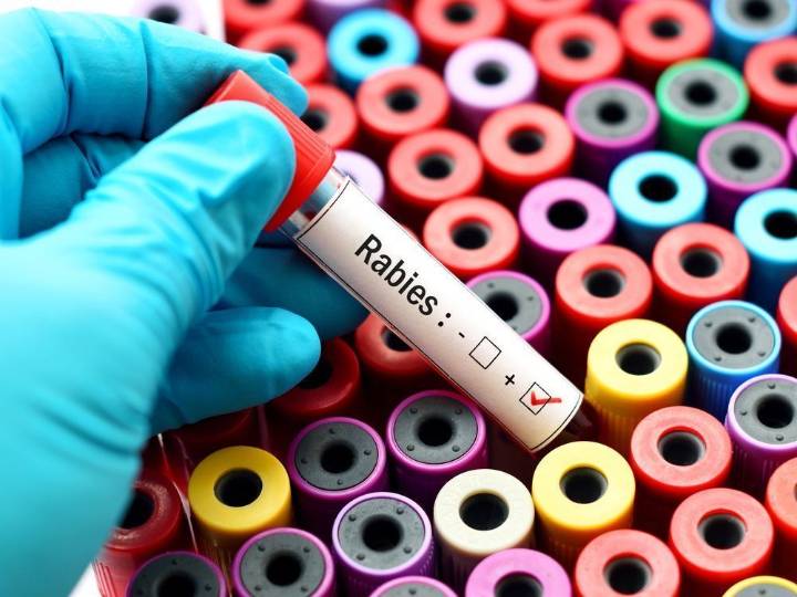 Centre Wellington man treated for rabies | Kingston/Frontenac This Week