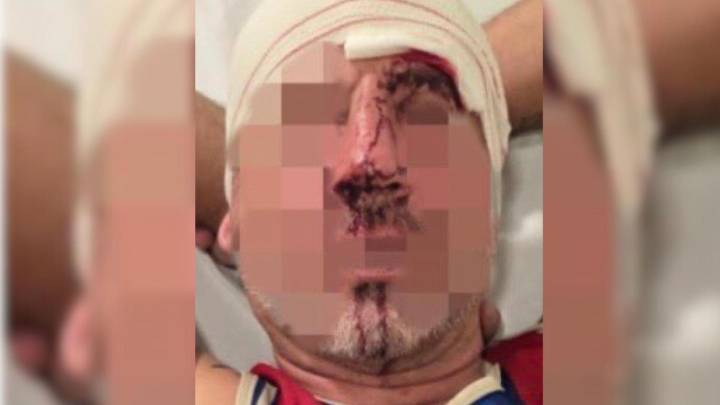 Brutal agresión de unos okupas a un vecino de L’Hospitalet: “Nos han amenazado con violarnos y quemarnos"