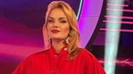 Eliana Guercio terminó con la cara deformada por un tratamiento estético