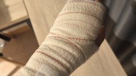 Un seguidor del Ceuta se rinde al Real Valladolid por el trato médico brindado: "Club señor"