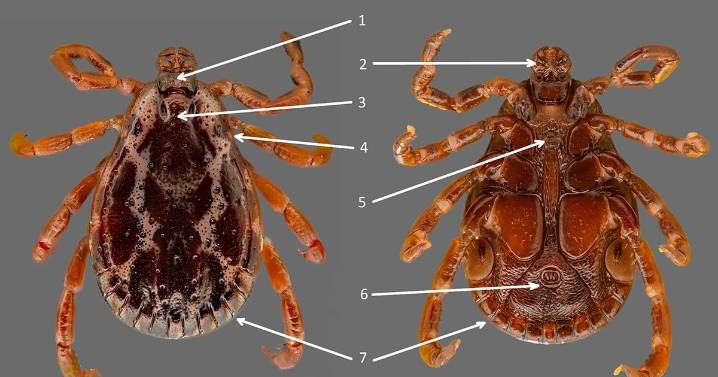 First ever tick-transmitted Rocky Mountain fever case confirmed in Quebec’s Eastern Townships