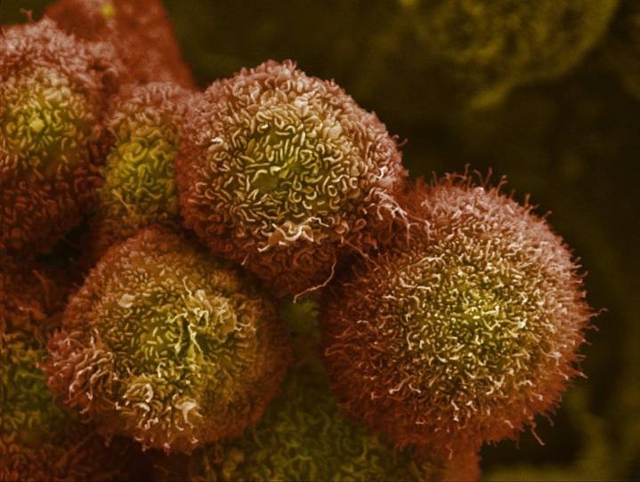 La “vacuna autoestopista” contra el cáncer logra resultados prometedores en 25 personas