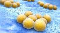 Dalbavancin No Better Than Standard Therapy for Complicated S. Aureus Bacteremia