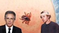 La peligrosa enfermedad que crece sin freno y afecta a varios famosos