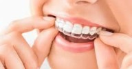 Consejos para cuidar la higiene bucodental y el tratamiento de ortodoncia invisible en verano