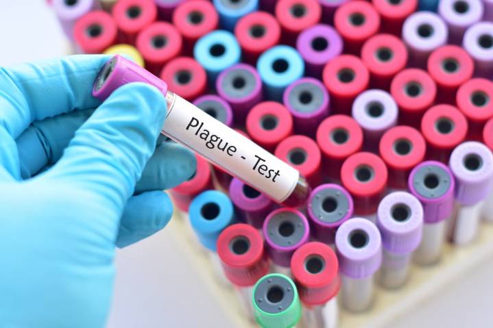Californian tests positive for plague after camping in Lake Tahoe area