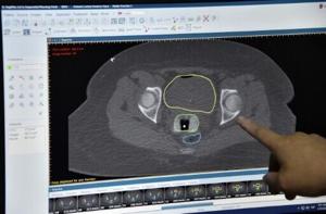 New cancer plan urged as survival improvements in England slow