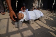 Malnourished kids arrive daily at a Gaza hospital as Netanyahu denies hunger