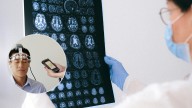 Habla por primera vez la persona que recibió implante de chip cerebral por parte de la empresa Neuralink