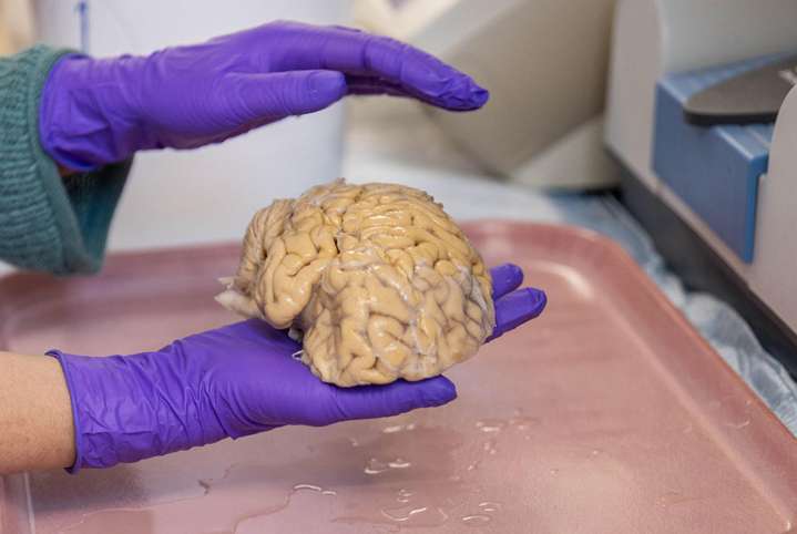 El cerebro de los ‘superancianos’ ofrece algunas claves de la eterna juventud