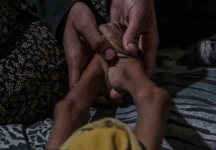 Ya suman más de 250 muertos por desnutrición en Gaza