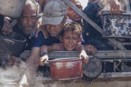 Once nuevos muertos en Gaza por desnutrición elevan a 300 el total de fallecidos de hambre