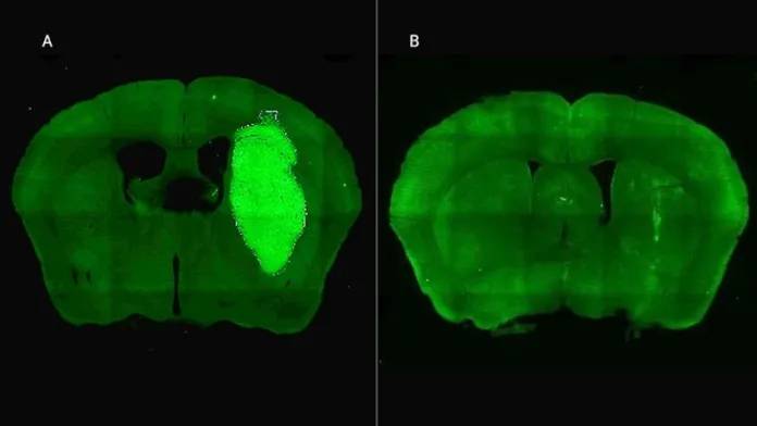 Importante avance de investigadores del Conicet en estrategias para frenar un tipo de cáncer cerebral