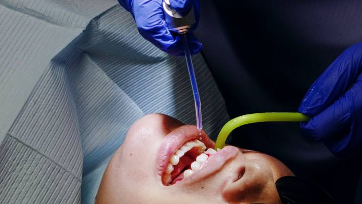 Family of 4-year-old with brain damage files a $22 million lawsuit against dentist – NBC Bay Area