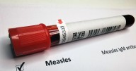 Spokane County resident presumed to have measles following exposure, symptoms