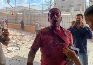 Un doble ataque contra el principal hospital del sur de Gaza causa 15 muertos, entre ellos 4 periodistas