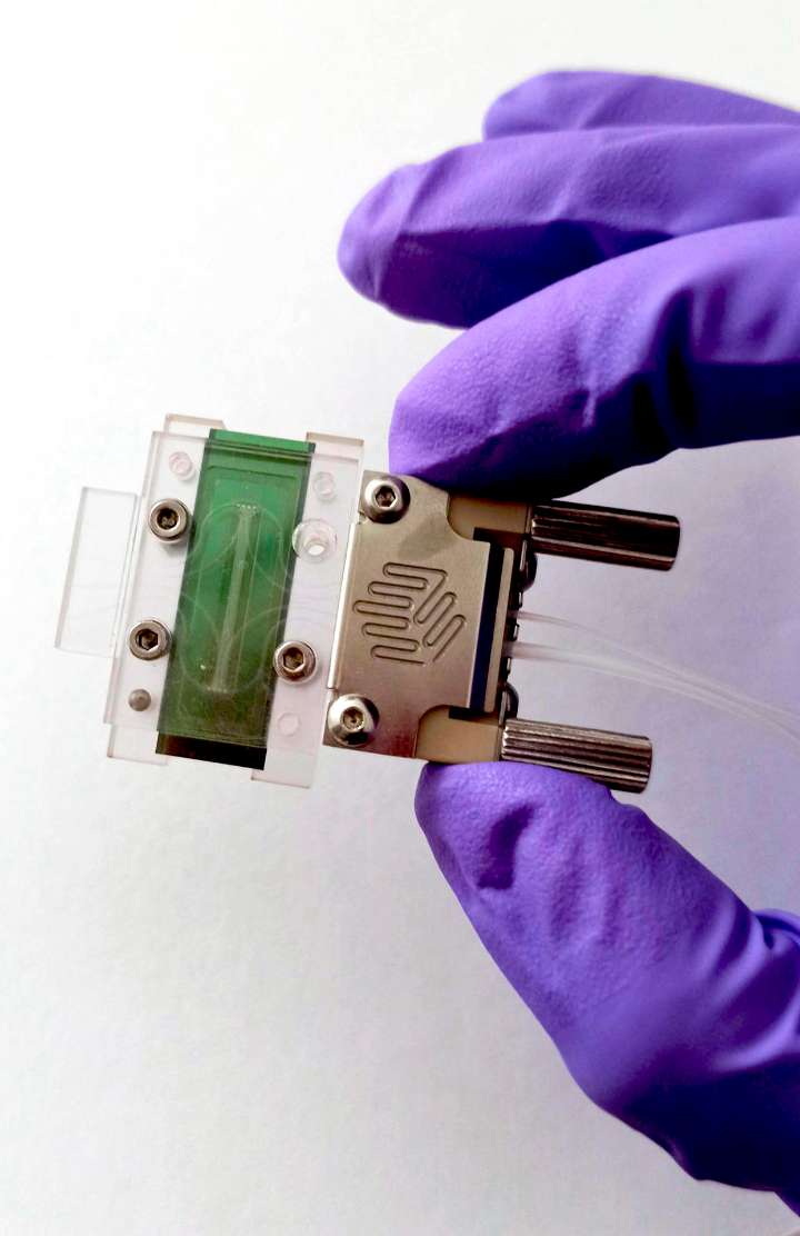 Minibiosensores para detectar el cáncer en minutos y a partir de una sola gota de muestra