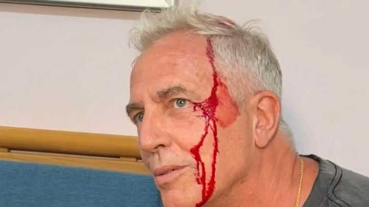 Marley sufrió un fuerte golpe en la cabeza en su visita a Tailandia